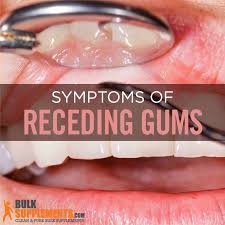 receding gums symptoms causes