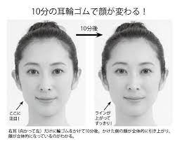 歯科医師 顎関節症に効果 輪ゴムで行うセルフケア 小顔になる スタイルがよくなる ケンカツ beauty diet anti aging exercise beauty advice