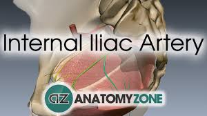 Maybe you would like to learn more about one of these? Internal Iliac Artery 3d Models Video Tutorials Notes Anatomyzone