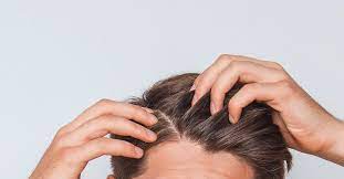scabs and sores on scalp pictures