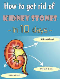 How To Get Rid Of Kidney Stones In 10 Days Thebeautymania