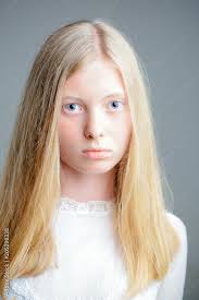with blond long hair albino