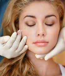 dermal fillers can improve your face