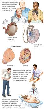 Nearly all testicular cancers start in the germ cells. Testicular Cancer Spectrum Health