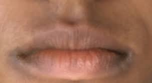 how do i fix lip discoloration photo
