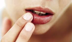 how to help your dry lips during winter