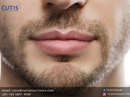 lip fillers what men can expect