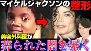 マイケルジャクソンはどんな整形をしていた？美容外科医が真相を暴きます - YouTube