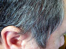 what causes pre graying in hair