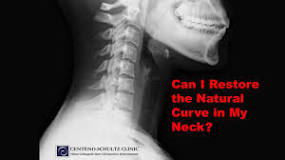 how-do-i-restore-the-natural-curve-in-my-neck