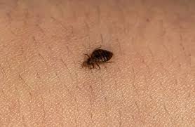 How To Get Rid Of Bed Bugs The