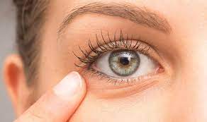 cure under eye wrinkles with home remes