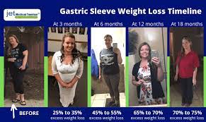 gastric sleeve weight loss chart and