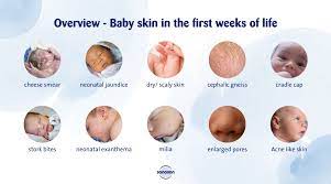 baby skin in the first weeks of life