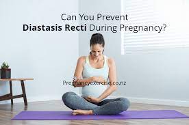 By addressing the factors i have mentioned and following a pre or post pregnancy program before commencing a pregnancy diastasis recti is reduced to a minimum therefore increasing your recovery and helping you get rid of your baby tummy quickly post birth. Can You Prevent Diastasis Recti During Pregnancy Pregnancy