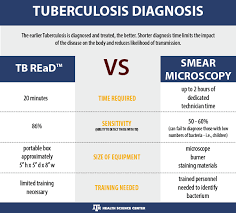 Tb Online Low Cost Tb Test Means Quicker More Reliable