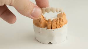 bur oak dental read our latest