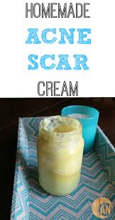homemade acne scar cream ancestral