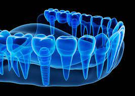 cone beam dental technology