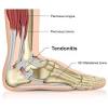 However, many tendons and ligaments consist of different parts that are subject to different loadings. 1