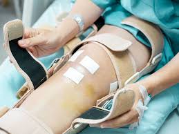 knee replacement infection treatment