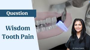how long does wisdom tooth pain last