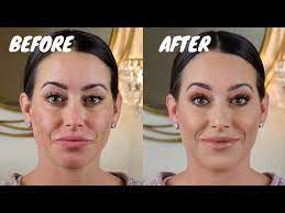 full coverage makeup for melasma