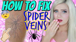 how to hide spider veins on your legs