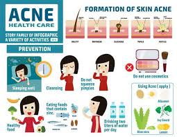 how to get rid of acne scars femina in