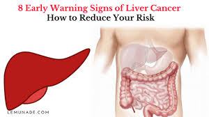 Yet the bump could also be from an injury, fluid buildup, or a hernia. 8 Early Warning Signs Of Liver Cancer How To Reduce Your Risk Lemunade