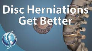can a disc herniation heal itself