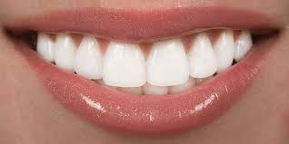 How White Is Too White For Your Smile River Edge Dentist