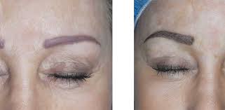 microblading and hair strokes fading