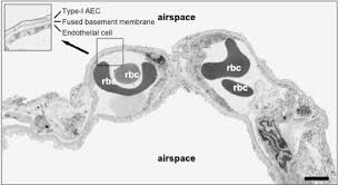 Alveolar Capillary Air Blood Barrier