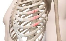 Image result for icd 10 code for right 6th rib fracture