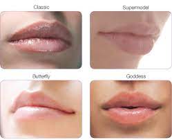 the best lip fillers with dr dan dhunna