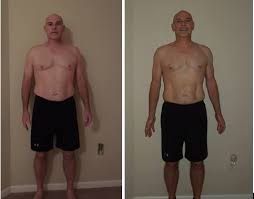 focus t25 before and after keith