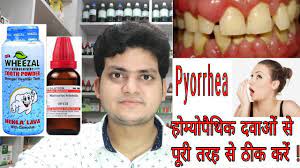 pyorrhea homeopathic cine for