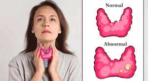 thyroid gland location and thyroid
