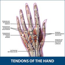 Severe edema increases tendon drag and likelihood of rupture. Tendon Transfers Of The Hand Florida Orthopaedic Institute