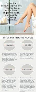 laser hair removal laser center