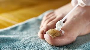effective treatments for toenail fungus