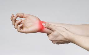 advanced carpal tunnel syndrome
