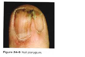 nail disorders flashcards quizlet