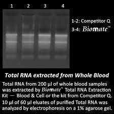 total rna extraction kit blood cell