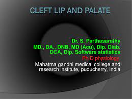ppt c left lip and palate powerpoint