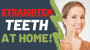 straighten your teeth at home naturally