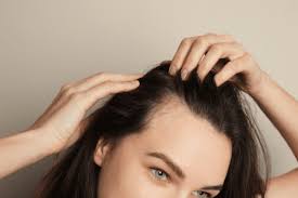 alopecia areata what causes patchy