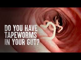 how to survive tapeworms warning