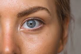 will eyelid surgery affect dry eyes
